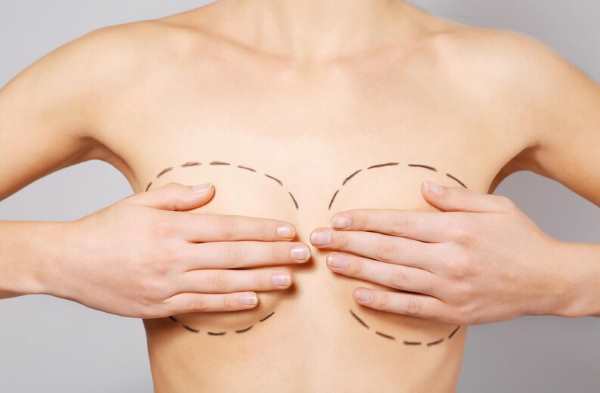 breast-reconstruction-1